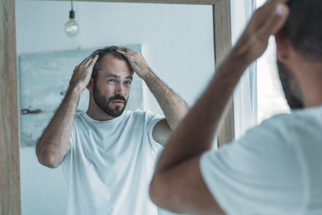 does low testosterone cause hair loss