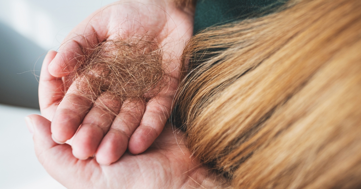 Woman holding strands of hair after noticing hair shedding, illustrating hair loss concerns related to hormonal imbalance