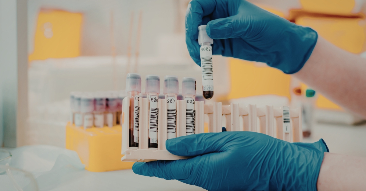 Healthcare professional performing a blood test with a vial, representing lab monitoring during TRT