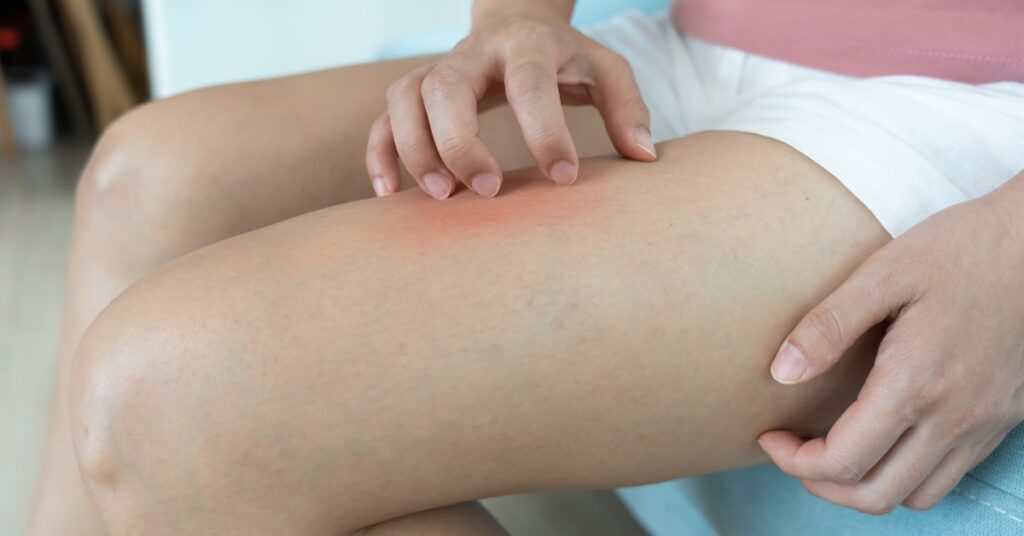 Woman scratching irritated skin during perimenopause