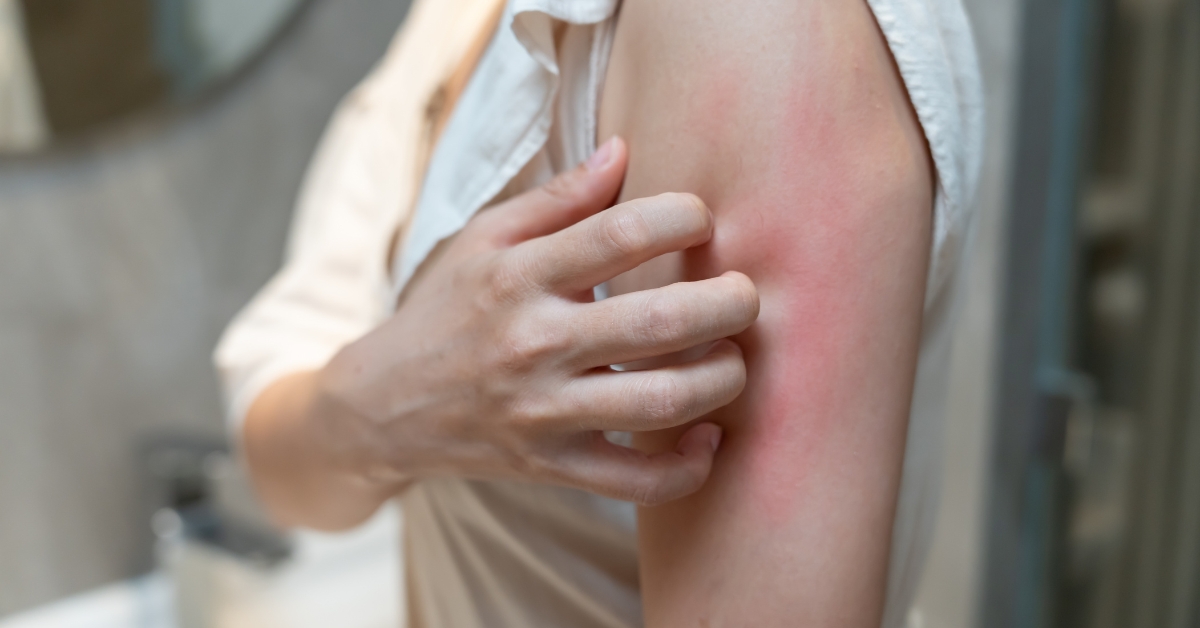 Woman experiencing itchy skin during menopause