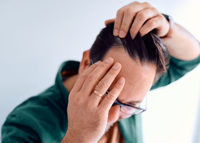 Middle-aged man examining his receding hairline in a mirror, worried and stressed about thinning hair and early male pattern baldness, close-up profile showing concern and self-care inspection